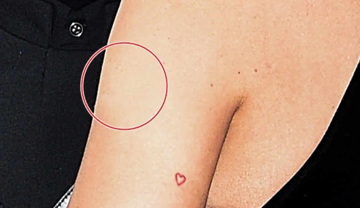 Tak hanya itu, saat berpose denga Travis plester tersebut punt terlihat meski samar. (HollywoodLife)