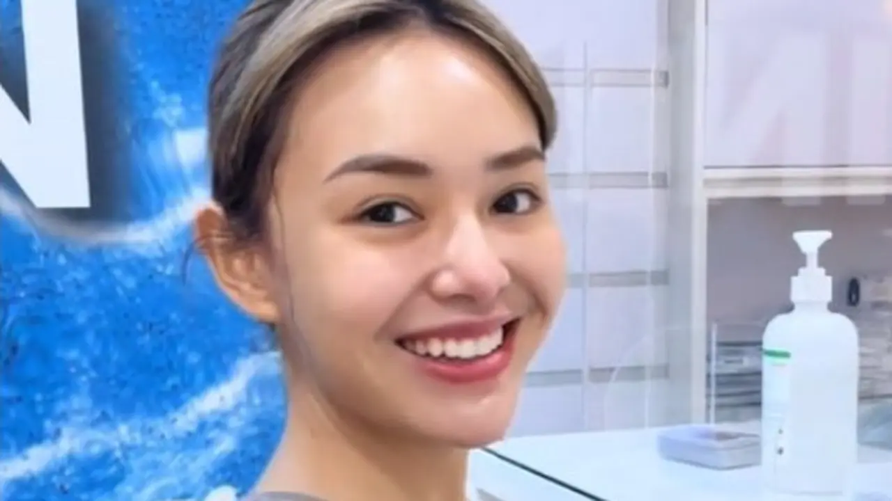Amanda Manopo Ungkap Biaya Perawatan di Klinik Kecantikan, Sekali Datang Bisa Habis Rp65 Juta.  foto: TikTok @dermaprosf
