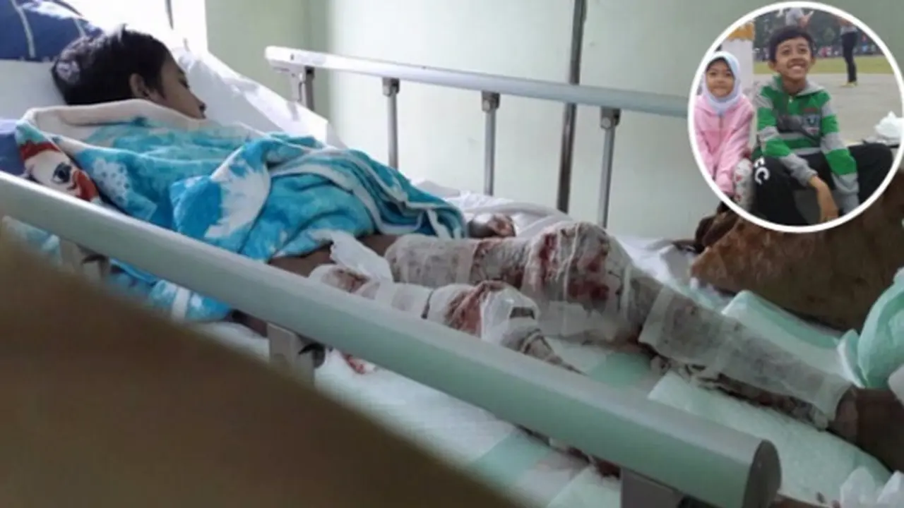 Kisah Helmi, Bocah 11 Tahun yang Ingin Bisa Berjalan Kembali