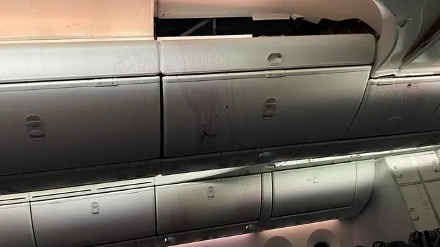 Pesawat Boeing Tujuan Washington D.C. Menukik Tajam di Tengah Penerbangan, Hampir 40 Penumpang Terluka