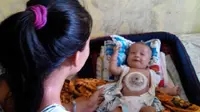 Bayi Jantung di Luar Tetap Tebar Senyum