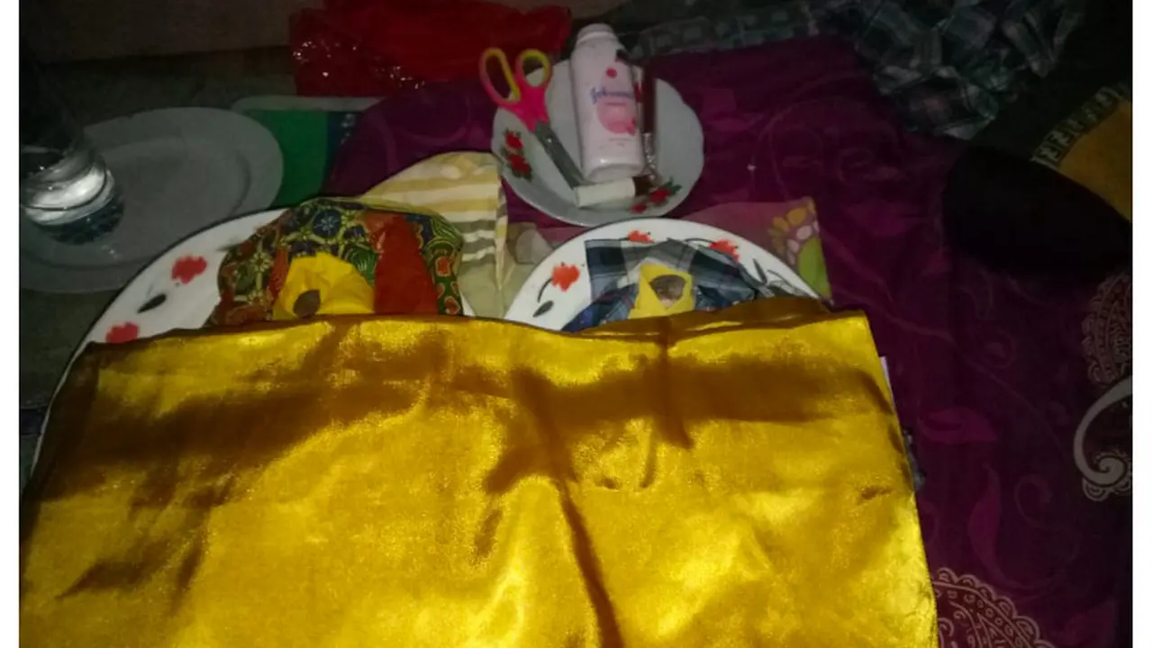 Dua buah batu yang dilahirkan oleh Harmin (Fauzan/Liputan6.com)