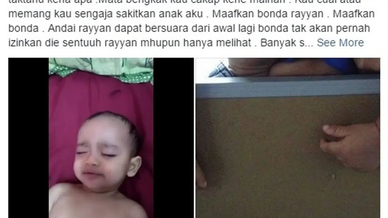 Balita Malang, Mata Lebam dan Tangan Bengkok Dianiaya Pengasuh