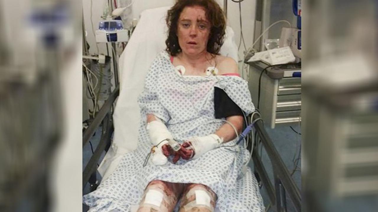 Disiksa Kekasih Sendiri, Gadis Ini Mendapat 54 Jahitan  