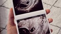 Dinda Hauw mengabarkan dirinya mengalami keguguran bayi kembar (dok.Instagram/@dindahw/https://www.instagram.com/p/CbaDUI8v1R7/Komarudin)