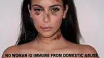 Seniman aleXsandro Palombo membuat sejumlah selebriti babak belur. Aktivis tersebut melakukannya sebagai kampanye bertajuk No Women is Immune from Domestic Violence menyambut Hari Internasional Penghapusan Kekerasan. (dailymail.co.uk)