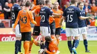 HUKUMAN BERAT - Pemain Dundee United FC, Nadir Cifti, terancam hukuman berat akibat menggigit kaki lawannya. (Daily Mail)