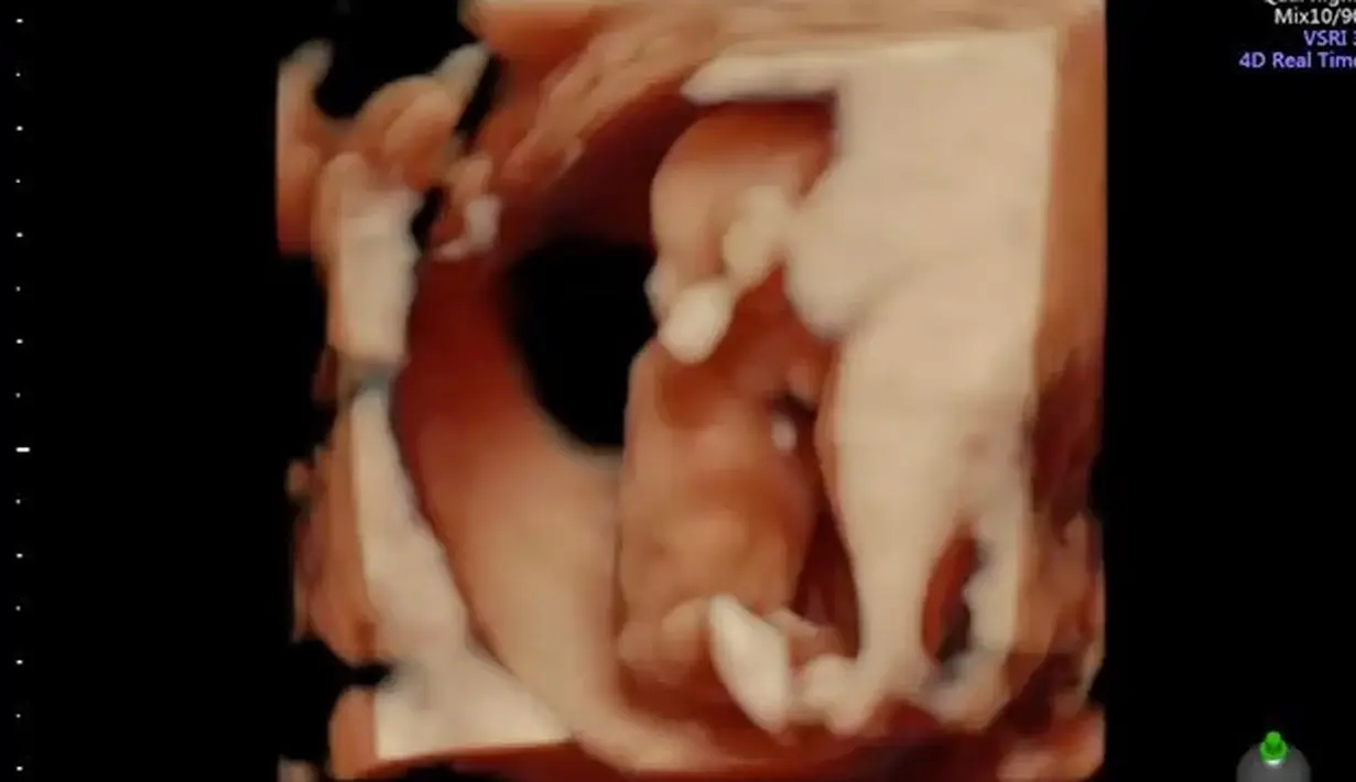 (Instagram/rachelmaryams)