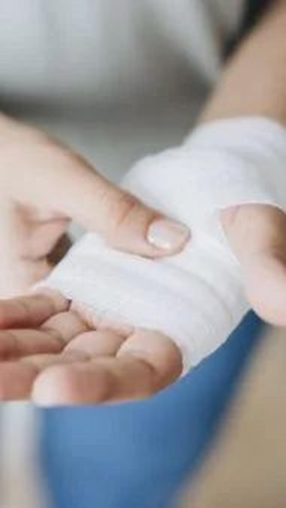 2. Sebagai Obat Luka Bakar<br>