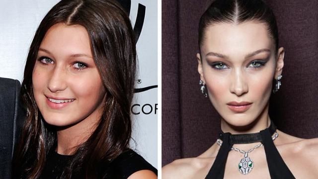 Artis-Artis Hollywood Ini Mukanya Beda Banget dari 10 Tahun Lalu