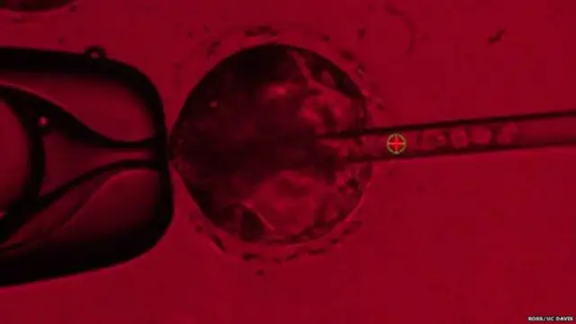 Stem cell atau sel induk manusia yang diinjeksi ke dalam embrio babi (Ross/UC Davis)