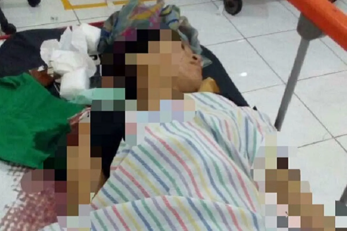 Korban Luka Bom Kampung Melayu Ternyata Mahasiswi Asal Brebes