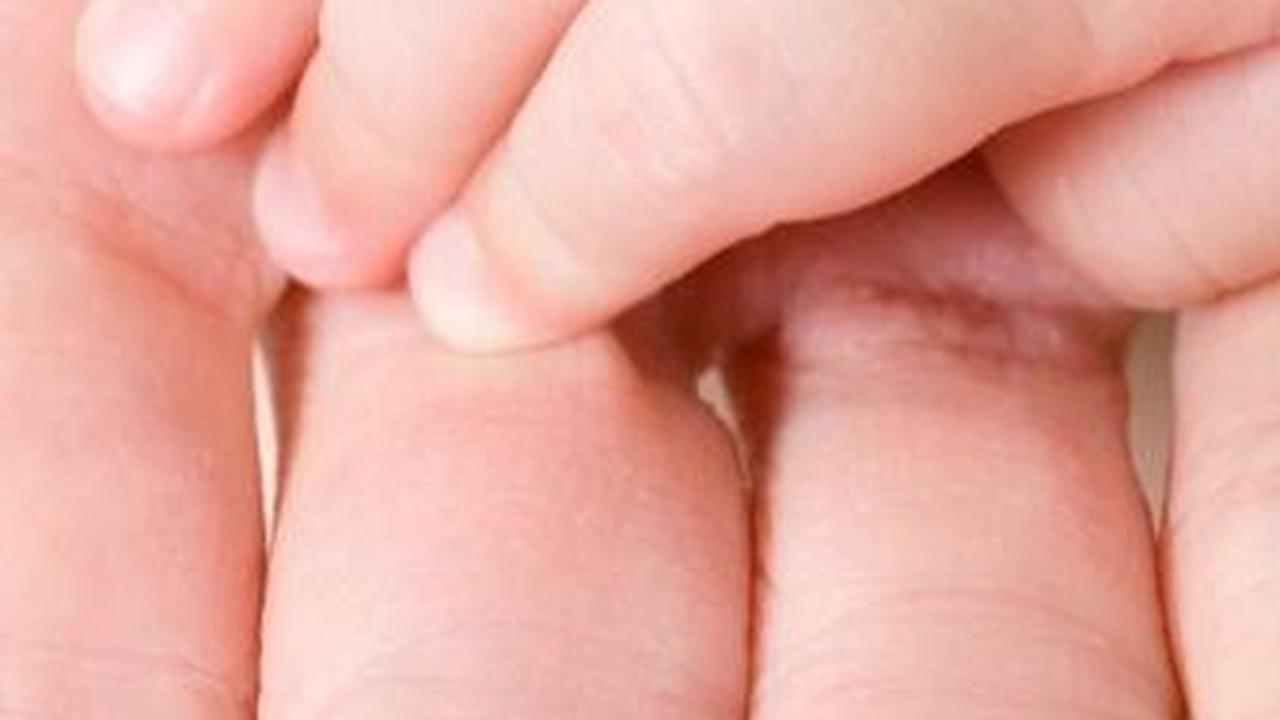 Meskipun skin to skin dapat membantu meredakan demam pada bayi, penting untuk tetap memantau kondisi bayi dan berkonsultasi dengan dokter jika demam tidak kunjung membaik. Selain itu, pastikan Anda melakukan skin to skin dengan benar dan dalam kondisi yan