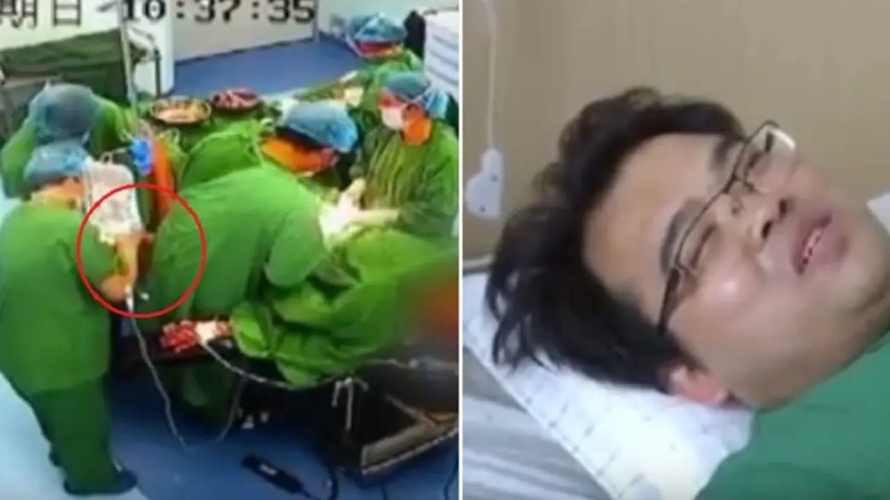 Dokter Bedah Lakukan 9 kali Operasi Saat Alami Usus Buntu