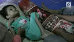 Seorang bocah mengalami kelumpuhan akibat menderita virus CMV, hingga kini hidup dalam kondisi memprihatinkan.