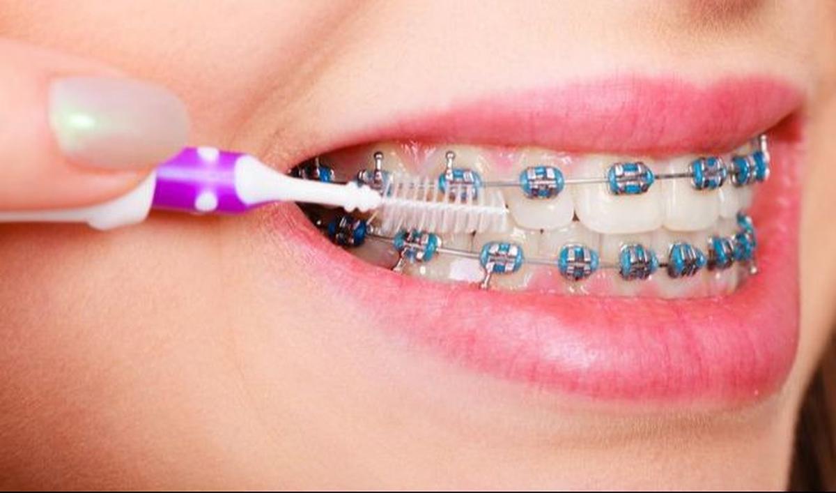 <b>Interdental Brush</b>