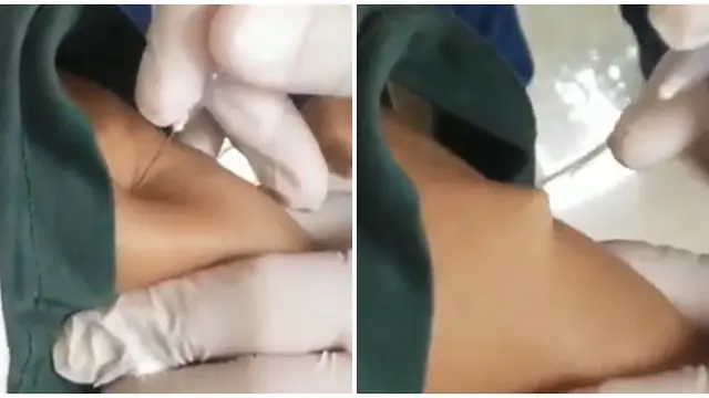 Viral Kakek Kulitnya Tak Tembus Jarum Suntik saat Divaksin, Bikin Geleng Kepala
