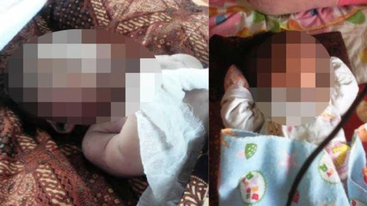 Derita bayi Husen meninggal akibat paru-paru lembap terkena asap