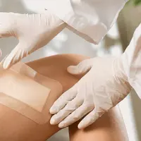 Jangan panik, ini cara mengobati luka terbuka dan memar! (Sumber: Medsupex)