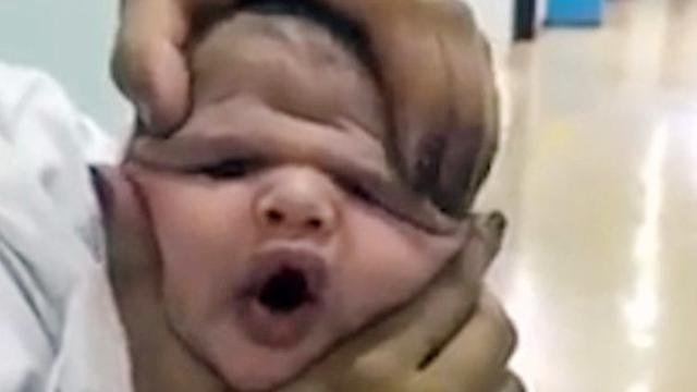 Jadikan Bayi Baru Lahir Mainan, Perawat di Sini Dipecat