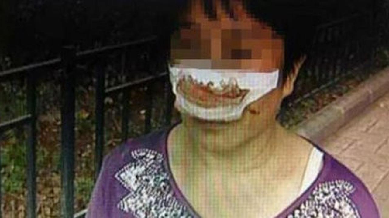 Telepon tak diangkat, suami di China emosi lalu makan hidung istri