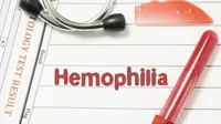 Benarkah Hemofilia Lebih Mudah Menyerang Pria? (Shidlovski/Shutterstock)