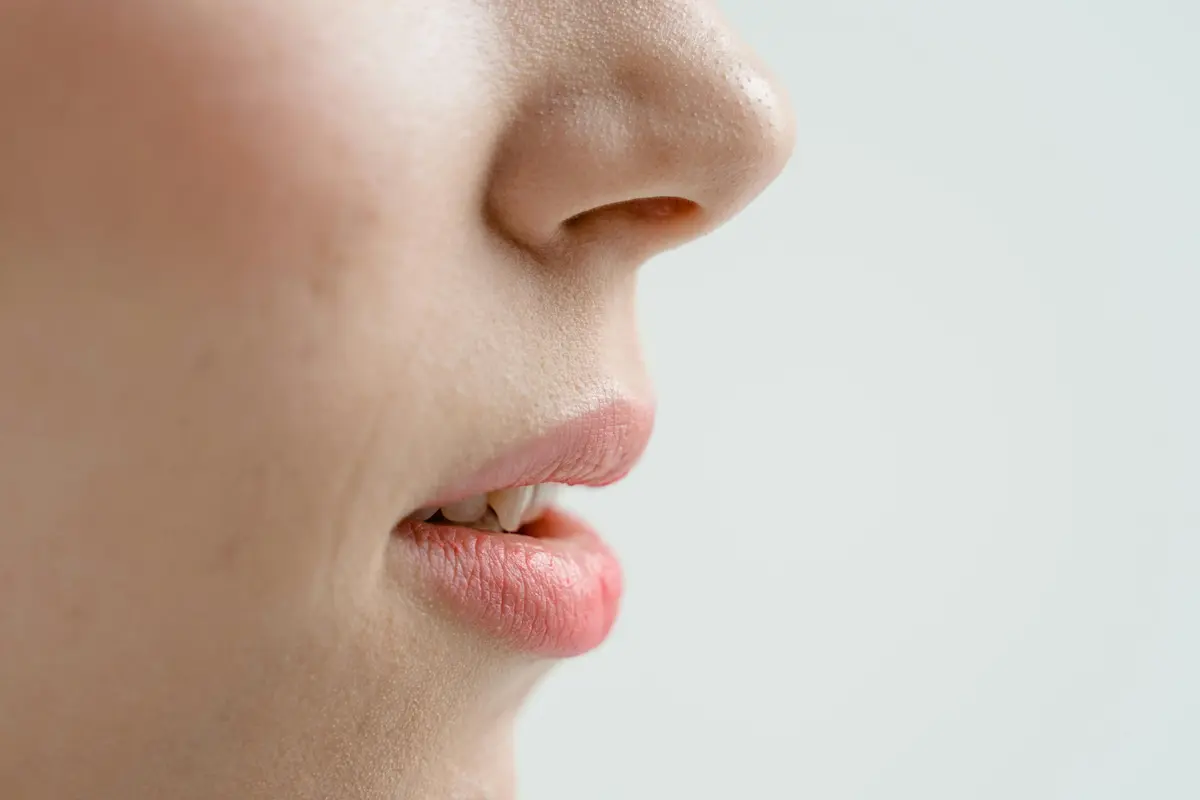 Bibir Kering