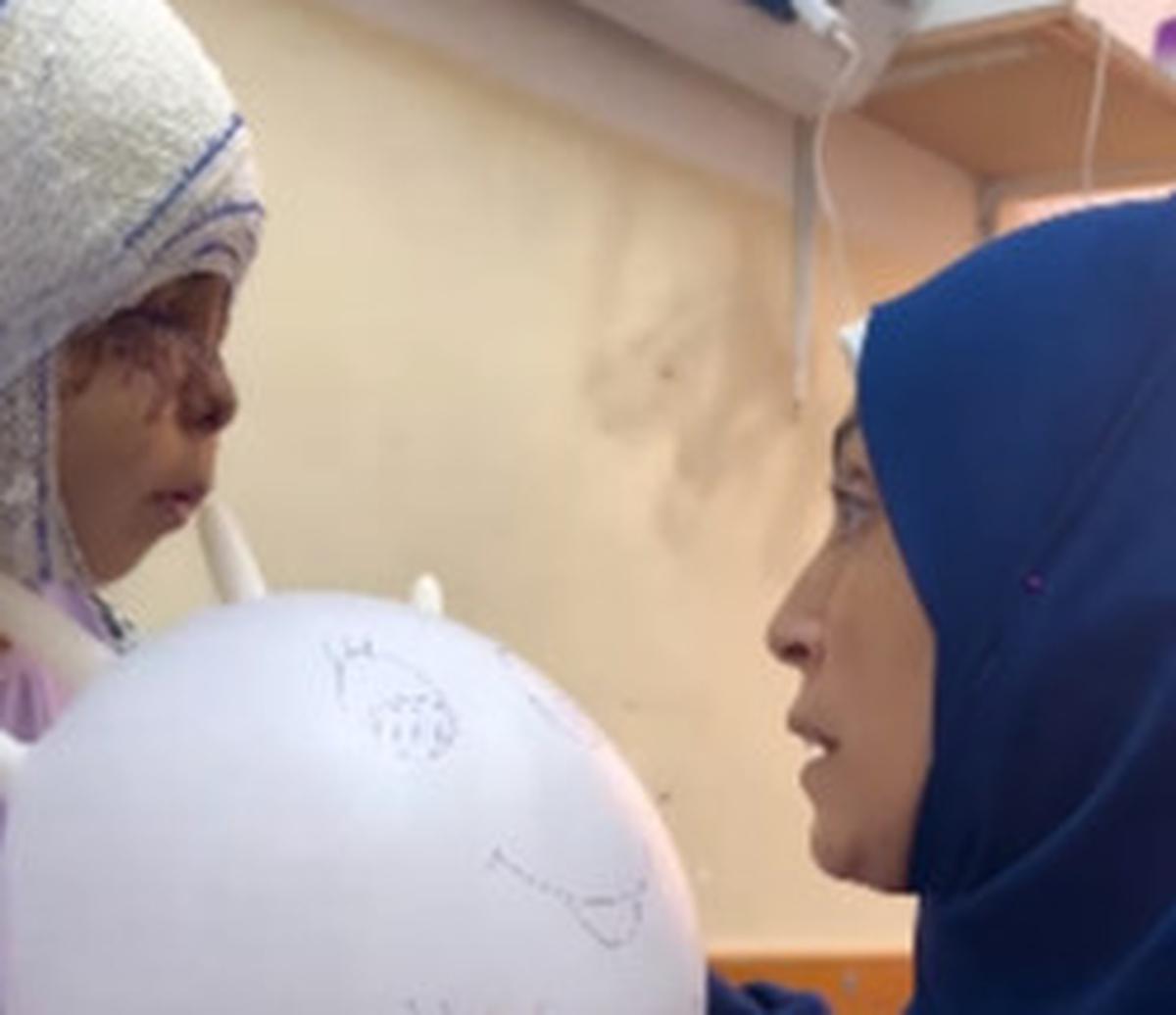 Pilunya Gadis Cilik Gaza Punya Luka Berat di Wajah Usai Serangan Israel