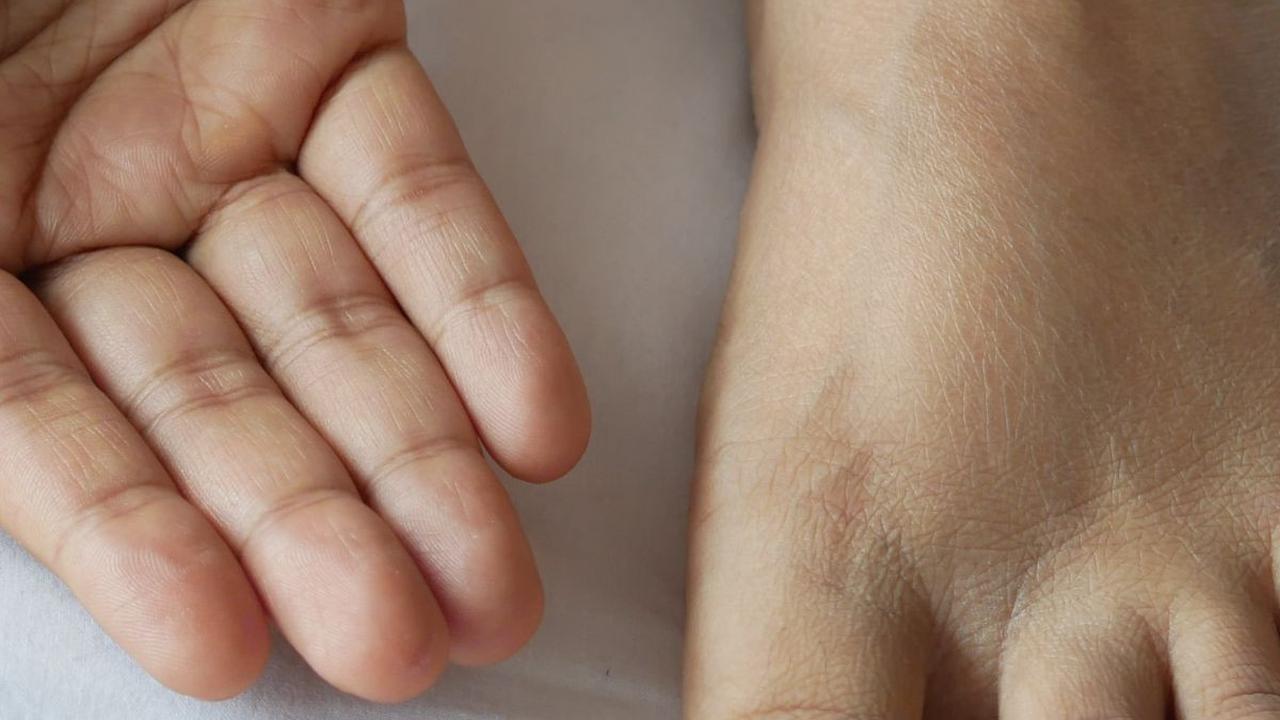 Otot kaki merupakan bagian integral dari tubuh manusia yang memungkinkan mobilitas dan aktivitas sehari-hari. Namun, cedera otot kaki, seperti otot kaki yang ketarik tentu dapat menyebabkan ketidaknyamanan yang signifikan dan bahkan membatasi kemampuan An