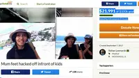 Aksi galang dana online di situs GoFundMe itu digagas Rohan Leonardo atas dasar kepeduliannya terhadap nasib istri yang dipotong kakinya oleh sang suami di Denpasar, Bali. (Foto: gofundme.com/Rohan Leonardo)
