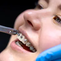 Warna behel yang harus dihindari/copyright Freepik