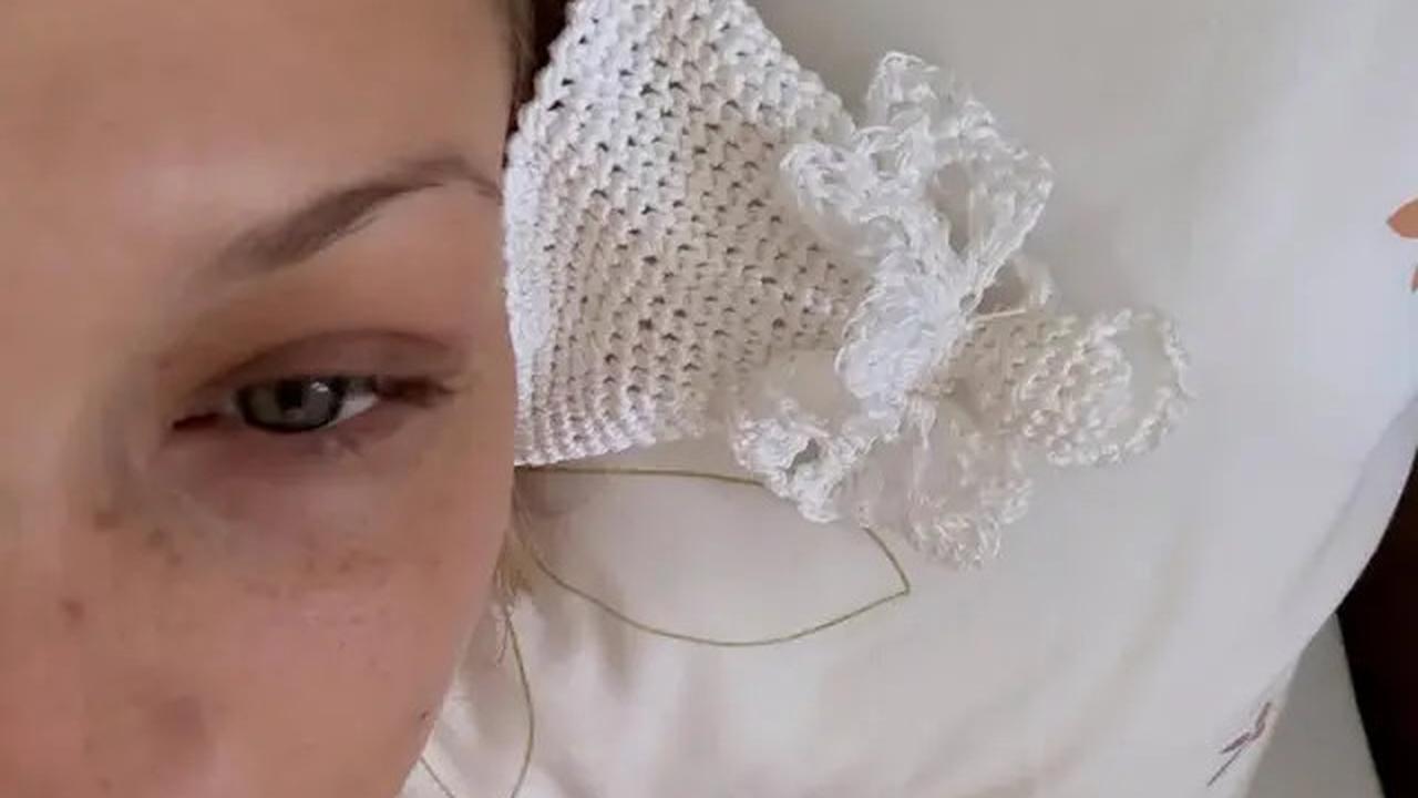 Potret Bella Hadid Berjuang Lawan Penyakit Lyme, Obat-obatannya Semeja Penuh