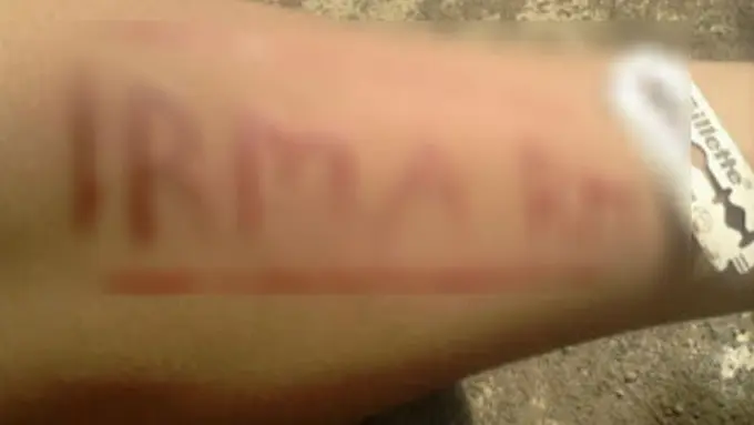 ABG Alay, Minta Maaf ke Pacar Sambil Silet-silet Tangan