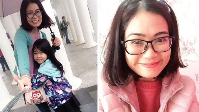 Potret Perjuangan Wanita yang Disiram Air Keras Oleh Mantan Suami Ini Bikin Miris