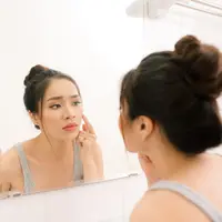 kandungan skincare yang cocok untuk fungal acne/shutterstock/makistock