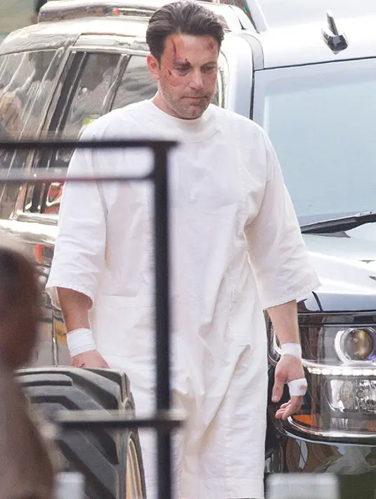 Aktor Hollywood, Ben Affleck tampak babak belur saat berjalan di jalanan kota Los Angeles. Ia sedang menyelesaikan salah satu filmya yang akan keluar pada tahun 2017. (Dailymail.co.uk)