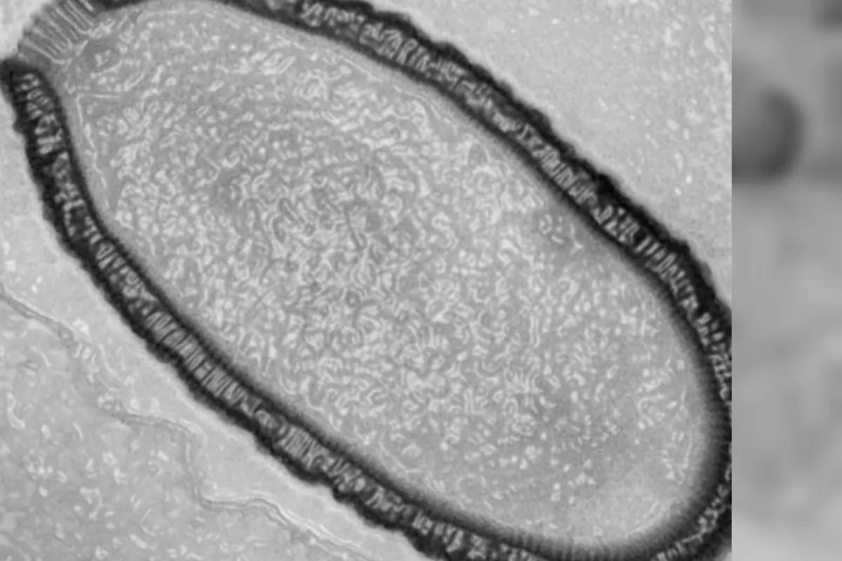 Virus Raksasa Ini Akan Dihidupkan Kembali**