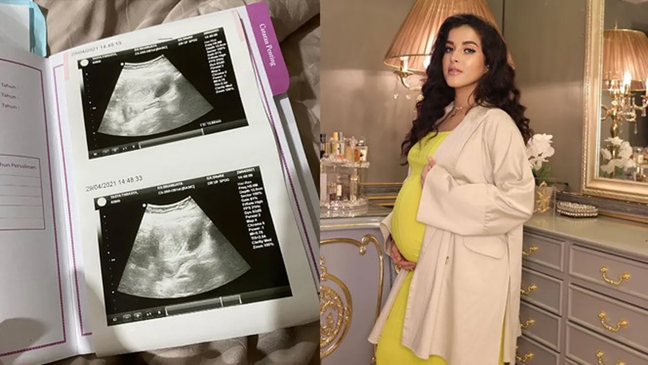 Keguguran Anak Kedua, Ini 8 Potret Perjalanan Kehamilan Tasya Farasya