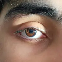 Ilustrasi mata. (dok. Mohammad O Siddiqui/Unsplash)