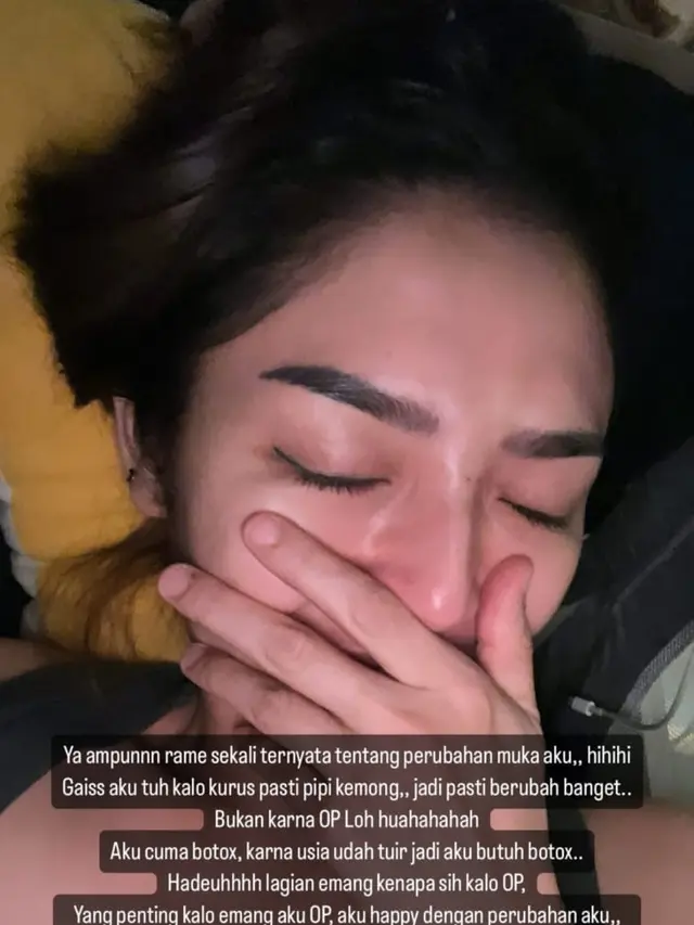 Siti Badriah Suntik Botox