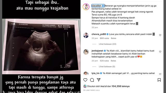 Unggahan Via Vallen. (Foto: Dok. Instagram @viavallen)