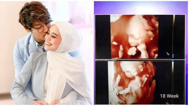 6 Potret Lesty Kejora Pamer Foto USG, Kini Usia Kandungan Sudah 6 Bulan