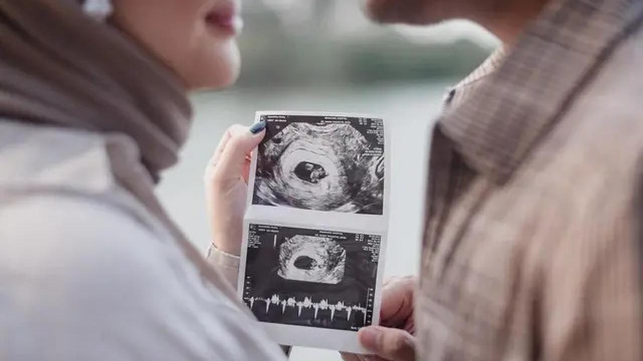 7 Potret Kesha Ratuliu Umumkan Hamil Anak Ketiga, KB IUD Bermasalah