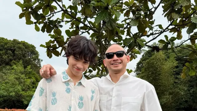 Potret Bare Face Bunga Citra Lestari Ziarah ke Makam Ashraf Jelang Puasa Ramadan, Kenakan Dress Floral dan Sandal Hermes