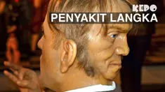 Beberapa orang ini harus mempunyai nasib yang kurang baik karena mempunyai penyakit yang tak biasa dan sulit untuk disembuhkan.