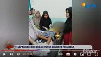 Telapak kaki seorang bocah di Kabupaten Buton, Sulawesi Selatan putus setelah ditebas menggunakan parang oleh pria dengan gangguan jiwa (ODGJ).