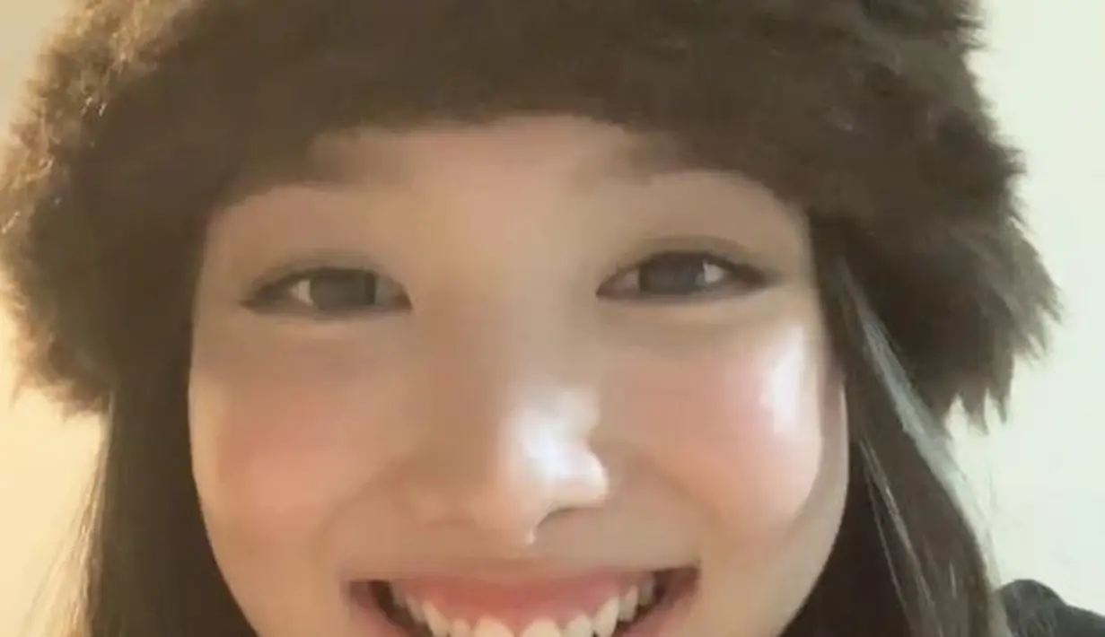 Padahal bunny teeth Nayeon sudah jadi ciri khasnya sejak lama. Dua gigi bagian tengah atasnya dulu tampak lebih panjang. [Pinterest]