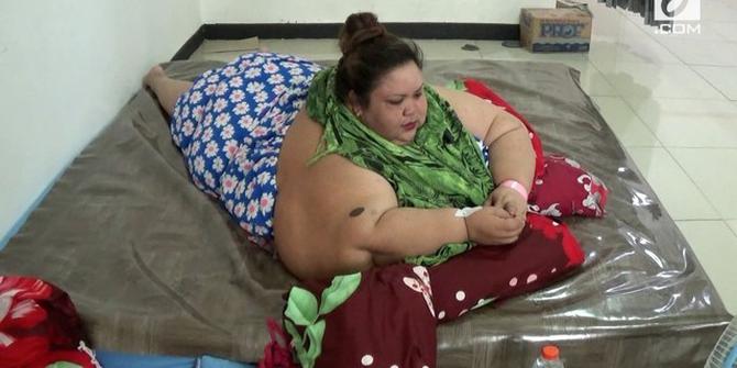 VIDEO: Lambung Penderita Obesitas Titi Wati akan Diperkecil