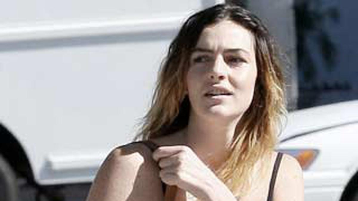 Ali Lohan Bantah Operasi Plastik