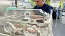Namun diagnosis awal tidak bagus karena otaknya kekurangan oksigen antara waktu kematian ibu dan kelahirannya," kata Mohammad Salameh, kepala IGD rumah sakit, kepada AFP. (Mai YAGHI / AFP)